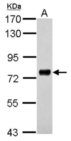 PHACTR3 Antibody, Novus Biologicals 0.1mL; Unlabeled:Antibodies, Polyclonal