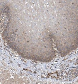 PHACTR4 Antibody, Novus Biologicals 25 &mu;L; Unlabeled:Antibodies, Polyclonal