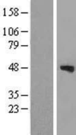 Novus Biologicals&trade;&nbsp;phakinin Overexpression Lysate