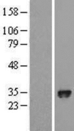 Novus Biologicals&trade;&nbsp;EGLN3/PHD3 Overexpression Lysate