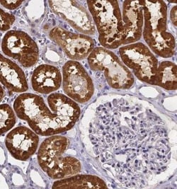 Phenylalanine Hydroxylase Antibody, Novus Biologicals:Antibodies:Primary