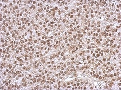 PHF10 Antibody, Novus Biologicals 0.1mL; Unlabeled:Antibodies, Polyclonal