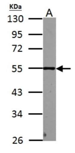 PHF10 Antibody, Novus Biologicals 0.1mL; Unlabeled:Antibodies, Polyclonal