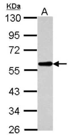 PHF10 Antibody, Novus Biologicals 0.1mL; Unlabeled:Antibodies, Polyclonal
