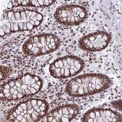 PHF10 Antibody, Novus Biologicals 25 &mu;L, Unlabeled:Antibodies, Polyclonal