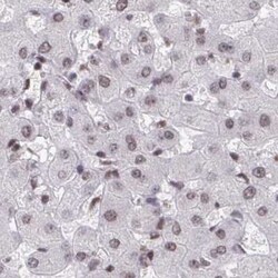 PHF10 Antibody, Novus Biologicals 25 &mu;L, Unlabeled:Antibodies, Polyclonal