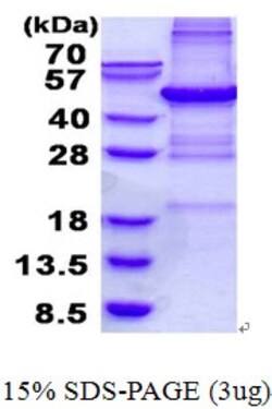 Novus Biologicals&trade;&nbsp;Recombinant Human PHF11 His Protein