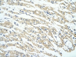 PHF11 Antibody, Novus Biologicals:Antibodies:Primary Antibodies