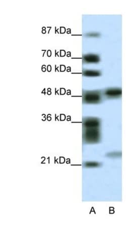 PHF11 Antibody, Novus Biologicals:Antibodies:Primary Antibodies