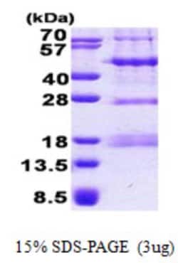 Novus Biologicals&trade;&nbsp;Recombinant Human PHF13 His Protein