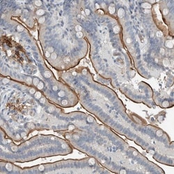 PHF15 Antibody, Novus Biologicals:Antibodies:Primary Antibodies