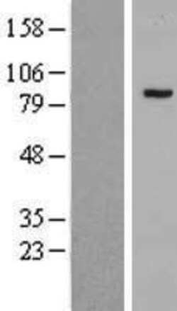 Novus Biologicals&trade;&nbsp;PHF16 Overexpression Lysate