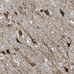 PHF16 Antibody, Novus Biologicals 0.1mL; Unlabeled:Antibodies, Polyclonal