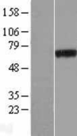 Novus Biologicals&trade;&nbsp;PHF19 Overexpression Lysate