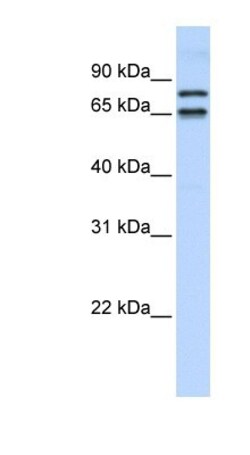 PHF20L1 Antibody, Novus Biologicals 100&mu;L; Unlabeled:Antibodies, Polyclonal