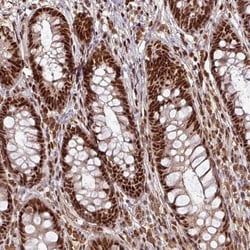 PHF23 Antibody, Novus Biologicals 0.1mL; Unlabeled:Antibodies, Polyclonal