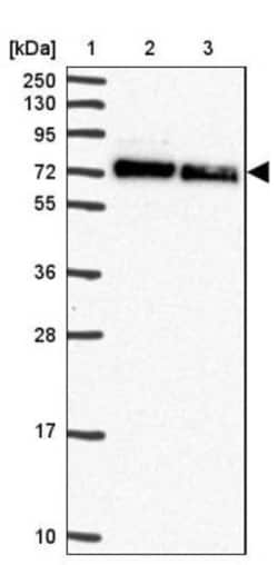 PHF23 Antibody, Novus Biologicals 0.1mL; Unlabeled:Antibodies, Polyclonal