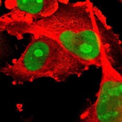 PHF6 Antibody, Novus Biologicals 0.1mL; Unlabeled:Antibodies, Polyclonal