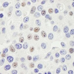 PHF6 Antibody, Novus Biologicals 0.1mL; Unlabeled:Antibodies, Polyclonal
