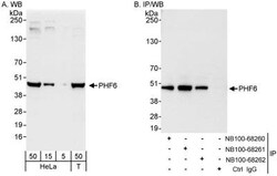 PHF6 Antibody, Novus Biologicals 0.1mL; Unlabeled:Antibodies, Polyclonal