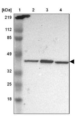 PHF6 Antibody, Novus Biologicals 0.1mL; Unlabeled:Antibodies, Polyclonal