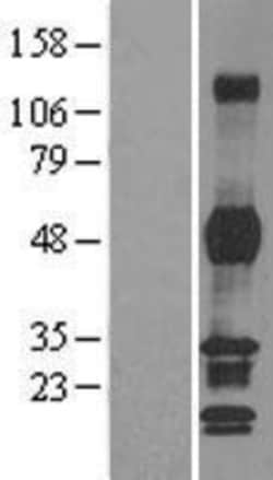 Novus Biologicals&trade;&nbsp;PHF7 Overexpression Lysate