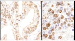 PHF8 Antibody, Novus Biologicals 0.1mL; Unlabeled:Antibodies, Polyclonal