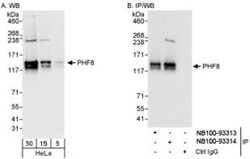 PHF8 Antibody, Novus Biologicals 0.1mL; Unlabeled:Antibodies, Polyclonal