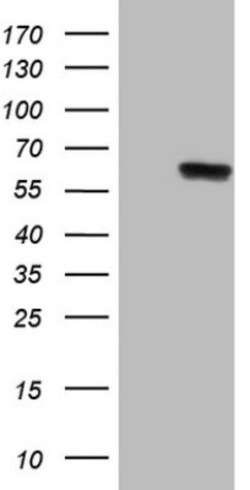 PHGDH Antibody (OTI5C4), Novus Biologicals 0.1mL; Unlabeled:Antibodies,