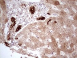 PHGDH Antibody (OTI5C4), Novus Biologicals 0.1mL; Unlabeled:Antibodies,