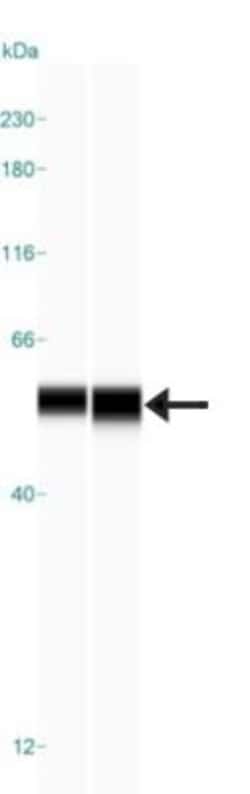 PHGDH Antibody, Novus Biologicals:Antibodies:Primary Antibodies