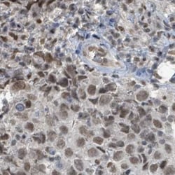 PHIP Antibody, Novus Biologicals 25 &mu;L, Unlabeled:Antibodies, Polyclonal