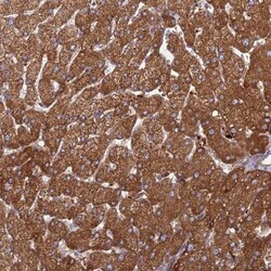 PHKA2 Antibody, Novus Biologicals 25 &mu;L, Unconjugated:Antibodies, Polyclonal