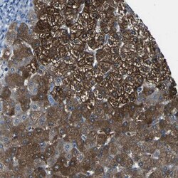 PHKG1 Antibody, Novus Biologicals 25 &mu;L; Unlabeled:Antibodies, Polyclonal