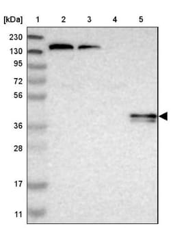 PHKG1 Antibody, Novus Biologicals 25 &mu;L; Unlabeled:Antibodies, Polyclonal
