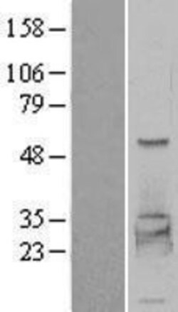Novus Biologicals&trade;&nbsp;PHKG2 Overexpression Lysate