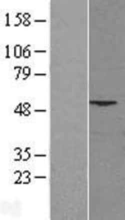 Novus Biologicals™ PHLDA1 Overexpression Lysate