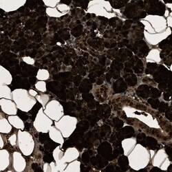PHLDA1 Antibody, Novus Biologicals 0.1mL; Unlabeled:Antibodies, Polyclonal