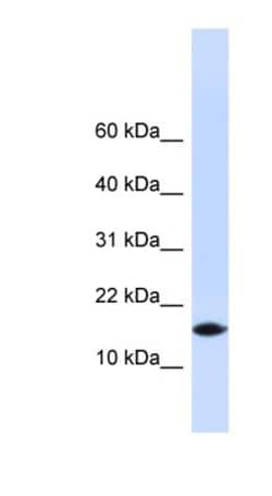 PHLDA3 Antibody, Novus Biologicals 100&mu;L; Unlabeled:Antibodies, Polyclonal