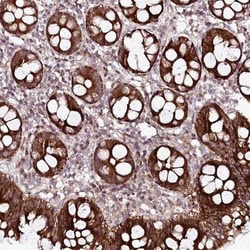 PHLDB1 Antibody, Novus Biologicals 0.1mL; Unlabeled:Antibodies, Polyclonal