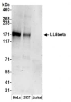PHLDB2 Antibody, Novus Biologicals 0.1mL:Antibodies, Polyclonal