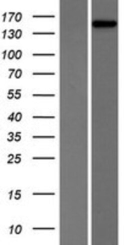 Novus Biologicals™ PHLPP2 Overexpression Lysate