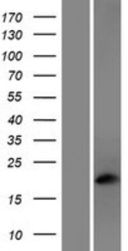 Novus Biologicals&trade;&nbsp;Phosducin Overexpression Lysate