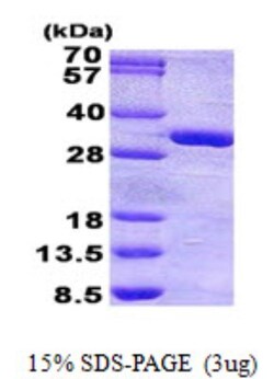 Novus Biologicals&trade;&nbsp;Recombinant Human PHOSPHO1 His Protein