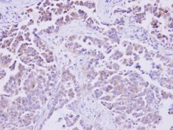 PHOSPHO1 Antibody, Novus Biologicals 0.1mL; Unlabeled:Antibodies, Polyclonal