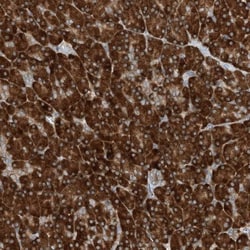 PHOSPHO2 Antibody, Novus Biologicals 0.1mL; Unlabeled:Antibodies, Polyclonal