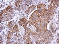 PHOSPHO2 Antibody, Novus Biologicals 0.1mL; Unlabeled:Antibodies, Polyclonal