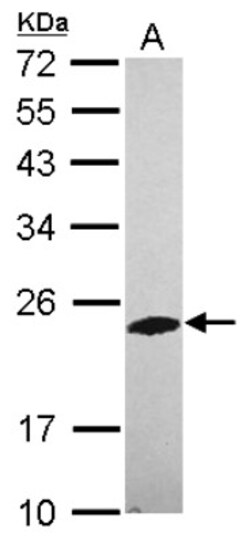PHOSPHO2 Antibody, Novus Biologicals 0.1mL; Unlabeled:Antibodies, Polyclonal