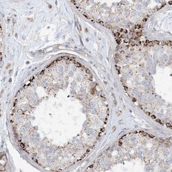 PHOSPHO2 Antibody, Novus Biologicals 25 &mu;L; Unlabeled:Antibodies, Polyclonal