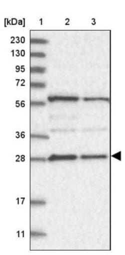 PHOSPHO2 Antibody, Novus Biologicals 25 &mu;L; Unlabeled:Antibodies, Polyclonal